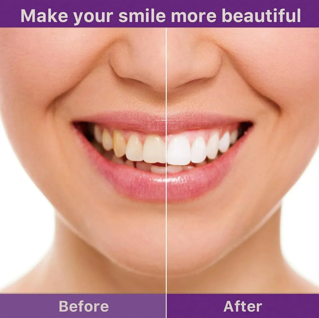 Smile Ease