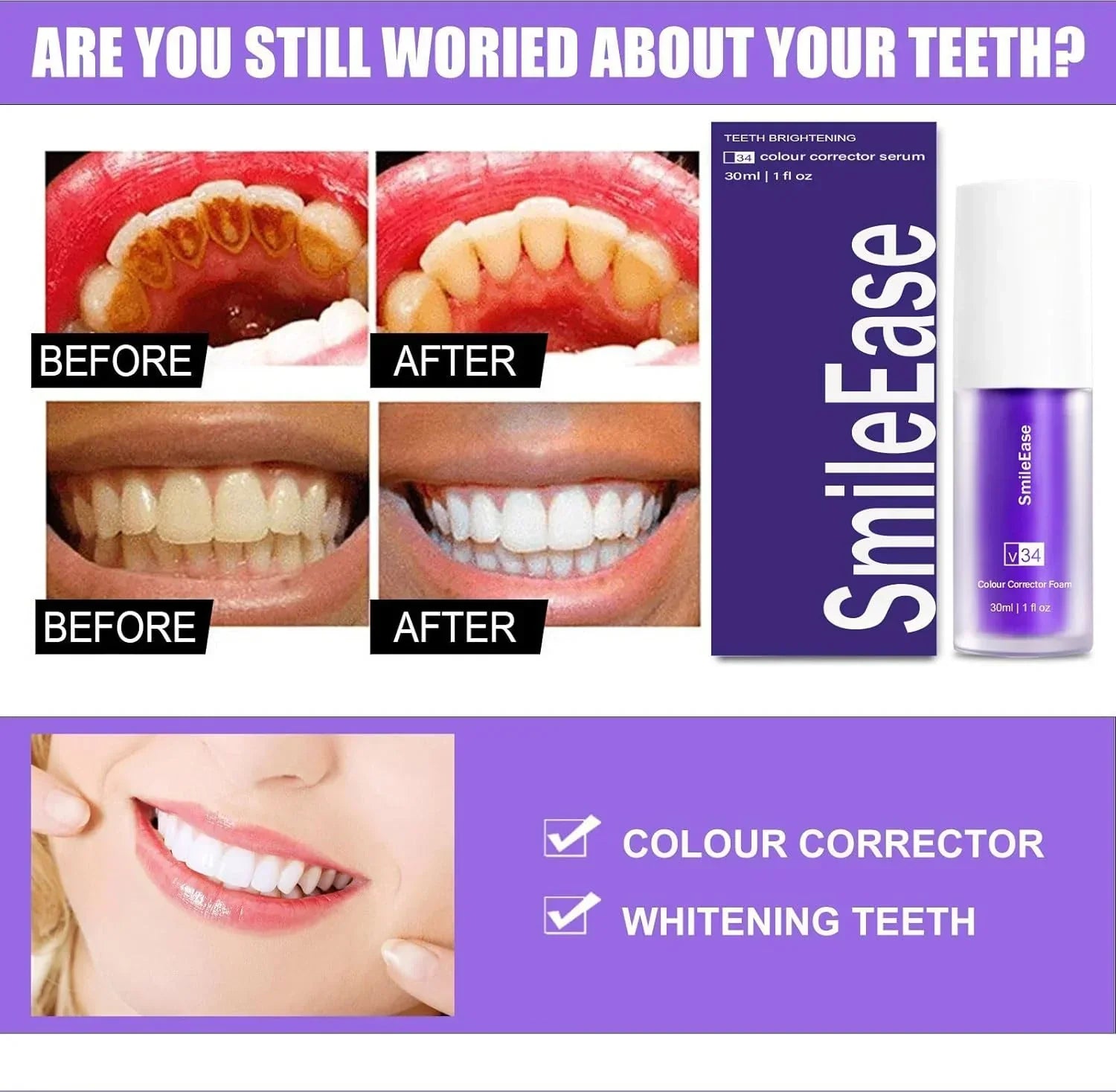 Smile Ease